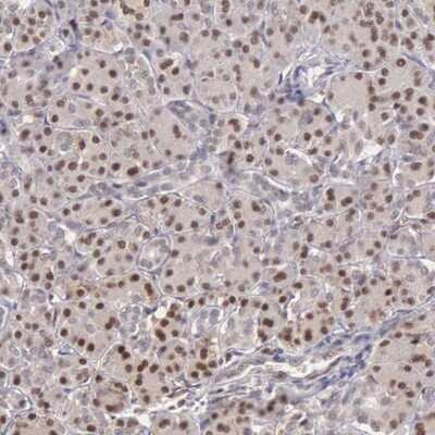 Immunohistochemistry-Paraffin: GRK3 Antibody [NBP1-90008]