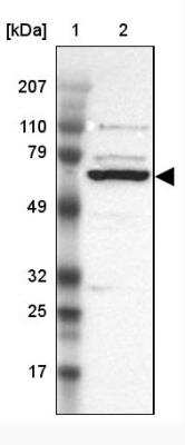 Western Blot: GRK3 Antibody [NBP1-90008]