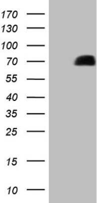 Western Blot: GRK4 Antibody (OTI4F5) [NBP2-45914]