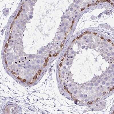 Immunohistochemistry-Paraffin: GRK4 Antibody [NBP2-37960]