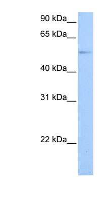 Western Blot: GRK4 Antibody [NBP1-55313]