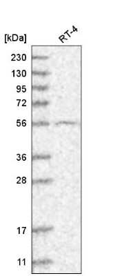 Western Blot: GRK4 Antibody [NBP2-55415]