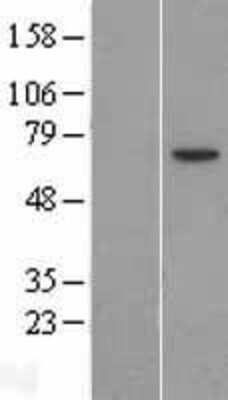 Western Blot: GRK4 Overexpression Lysate [NBP2-04793]