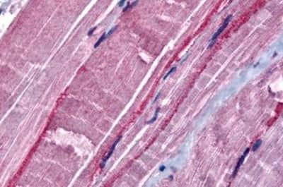 Immunohistochemistry-Paraffin: GRK5 Antibody [NBP3-14368]