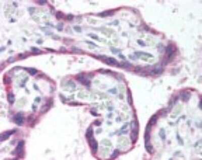 Immunohistochemistry-Paraffin: GRK5 Antibody [NBP2-24580]