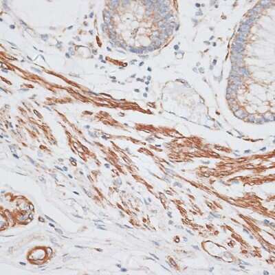 Immunohistochemistry-Paraffin: GRK5 Antibody - BSA Free [NBP3-04998]