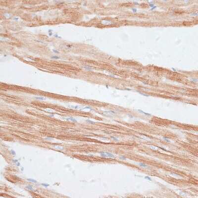 Immunohistochemistry-Paraffin: GRK5 Antibody - BSA Free [NBP3-04998]