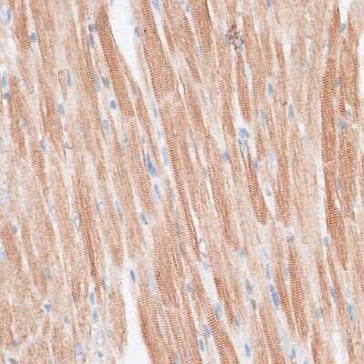 Immunohistochemistry-Paraffin: GRK5 Antibody - BSA Free [NBP3-04998]