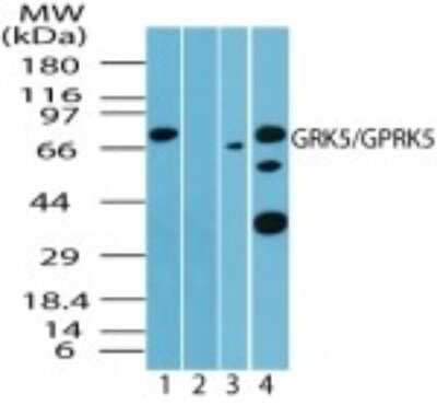 Western Blot: GRK5 Antibody [NBP2-24580]