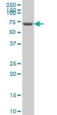 Western Blot: GRK6 Antibody (2C3) [H00002870-M05]