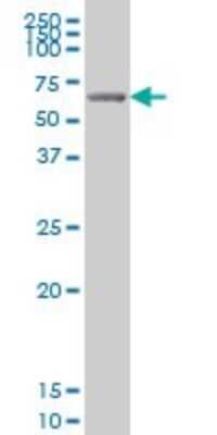 Western Blot: GRK6 Antibody (8B7) [H00002870-M07]