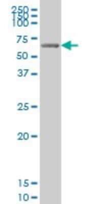 Western Blot: GRK6 Antibody (8B7) [H00002870-M07]