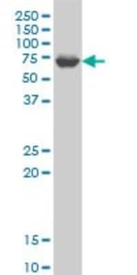 Western Blot: GRK6 Antibody (8D4) [H00002870-M10]