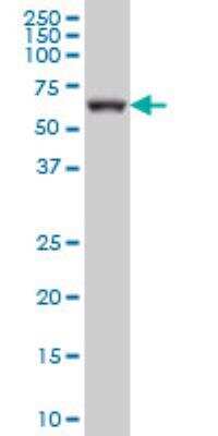Western Blot: GRK6 Antibody (8D9) [H00002870-M09]