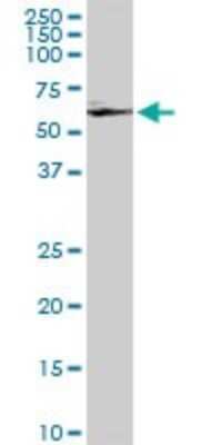 Western Blot: GRK6 Antibody (8D9) [H00002870-M09]