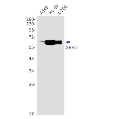 Western Blot: GRK6 Antibody (S07-3E4) [NBP3-19869]