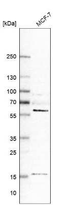 Western Blot: GRK6 Antibody [NBP1-83334]