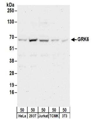 Western Blot: GRK6 Antibody [NBP2-32197]