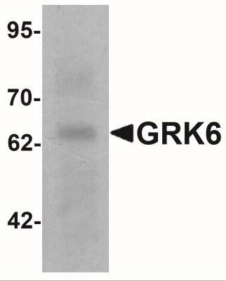 Western Blot: GRK6 AntibodyBSA Free [NBP2-41248]