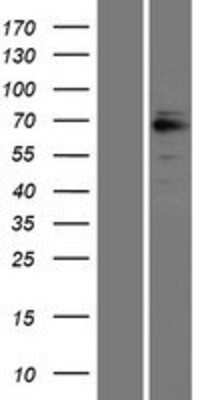 Western Blot: GRK6 Overexpression Lysate [NBL1-11344]