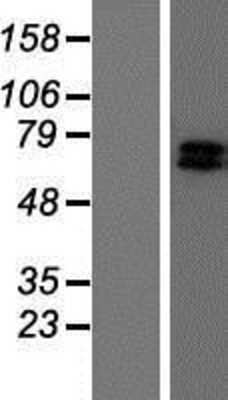 Western Blot: GRK6 Overexpression Lysate [NBP2-08929]