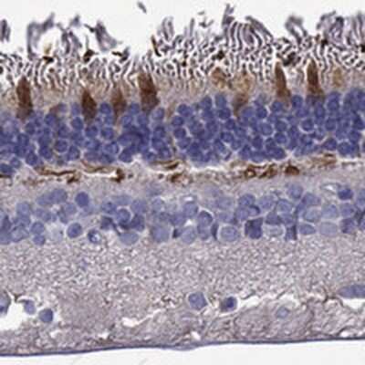 Immunohistochemistry-Paraffin: GRK7 Antibody [NBP3-17500]