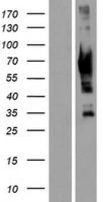 Western Blot: GRK7 Overexpression Lysate [NBP2-05583]