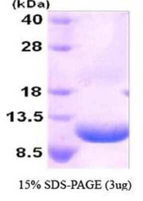 SDS-PAGE: Recombinant Human GRO2 His Protein [NBC1-22944]