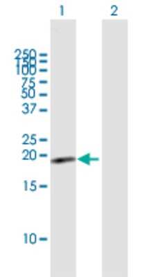 Western Blot: GRP Antibody [H00029094-B01P]