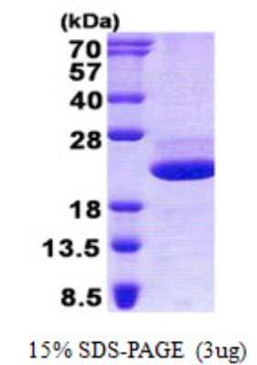 SDS-PAGE: Recombinant Human GRP His Protein [NBP2-23190]