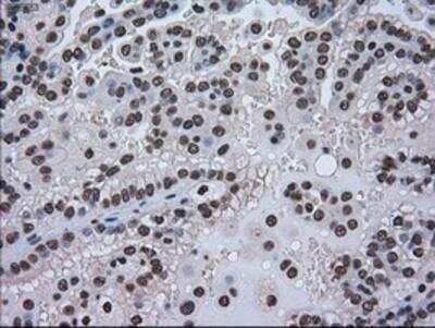 Immunohistochemistry-Paraffin: GRP75/HSPA9B/Mortalin Antibody (OTI9F8) [NBP1-47801]