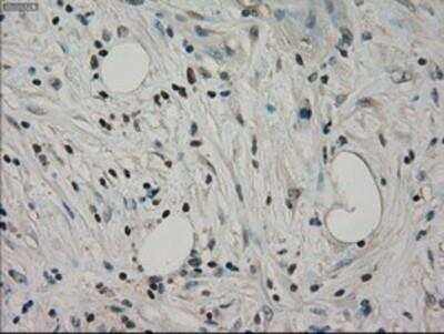 Immunohistochemistry-Paraffin: GRP75/HSPA9B/Mortalin Antibody (OTI9F8) [NBP1-47801]