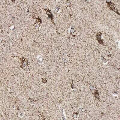 Immunohistochemistry-Paraffin: GRP75/HSPA9B/Mortalin Antibody [NBP1-89729]