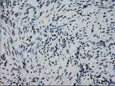 Immunohistochemistry: GRP75/HSPA9B/Mortalin Antibody (OTI9F8) - Azide and BSA Free [NBP2-70963]