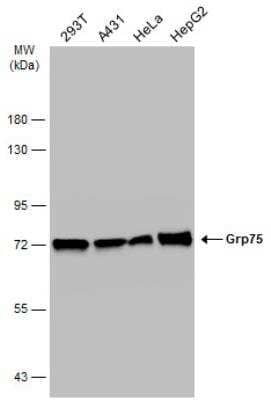 Western Blot: GRP75/HSPA9B/Mortalin Antibody [NBP1-31596]