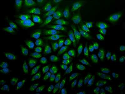 Immunocytochemistry/ Immunofluorescence: GRP78/HSPA5 Antibody (1H11-1H7) [NBP2-12888]
