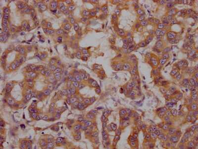 Immunohistochemistry: GRP78/HSPA5 Antibody (4H12) [NBP3-15138]