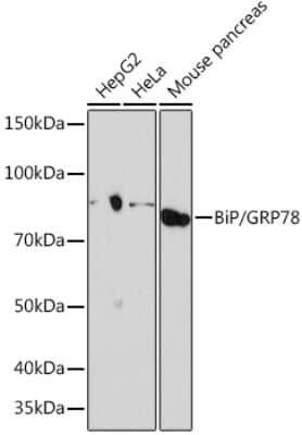 Western Blot: GRP78/HSPA5 Antibody (8J5M2) [NBP3-16511]