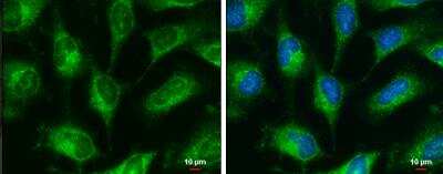 Immunocytochemistry/ Immunofluorescence: GRP78/HSPA5 Antibody [NBP2-16749]