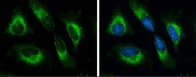 Immunocytochemistry/ Immunofluorescence: GRP78/HSPA5 Antibody [NBP2-16749]