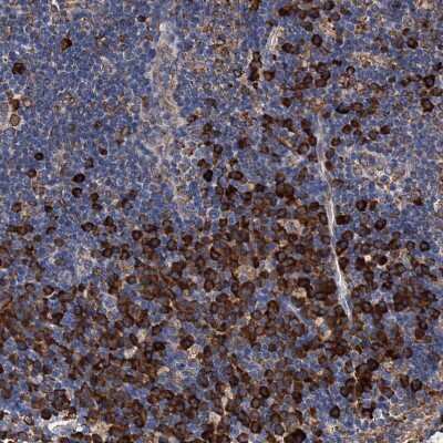 Immunohistochemistry-Paraffin: GRP78/HSPA5 Antibody [NBP1-89968]