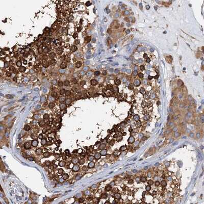 Immunohistochemistry-Paraffin: GRP78/HSPA5 Antibody [NBP1-89968]