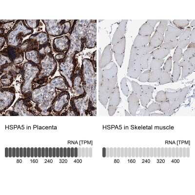 Immunohistochemistry-Paraffin: GRP78/HSPA5 Antibody [NBP1-89969]