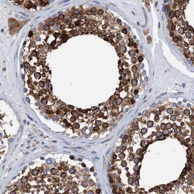 Immunohistochemistry-Paraffin: GRP78/HSPA5 Antibody [NBP1-89969]