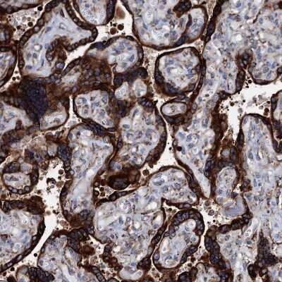 Immunohistochemistry-Paraffin: GRP78/HSPA5 Antibody [NBP1-89969]