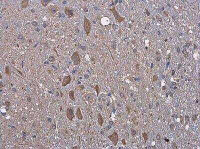 Immunohistochemistry-Paraffin: GRP78/HSPA5 Antibody [NBP2-16749]