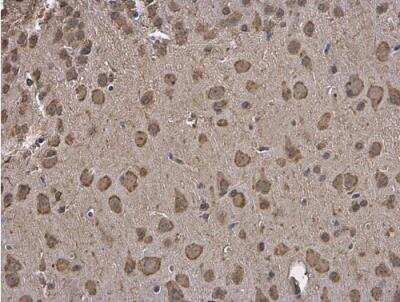 Immunohistochemistry-Paraffin: GRP78/HSPA5 Antibody [NBP2-16749]