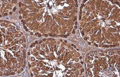 Immunohistochemistry-Paraffin: GRP78/HSPA5 Antibody [NBP2-16749]
