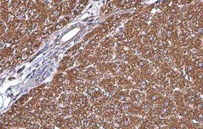 Immunohistochemistry-Paraffin: GRP78/HSPA5 Antibody [NBP2-16749]