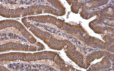 Immunohistochemistry-Paraffin: GRP78/HSPA5 Antibody [NBP2-16749]